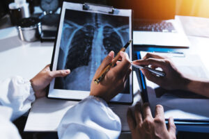 NGR-hTNF Treatment for Malignant Pleural Mesothelioma