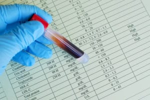 Guar Gum Improves Lipid Profiles in Subjects with Type 2 Diabetes Mellitus