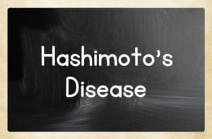 Combination of Selenium and Myo-Inositol Reduces Thyroid Stimulating Hormone Levels in Subjects with Hashimoto Thyroiditis