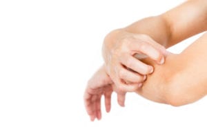 What is Mast Cell Activation Syndrome?