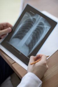 Saffron (Crocus sativus L.) Improves Antioxidant Capacity and Inflammation in Subjects with COPD
