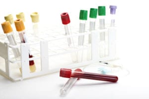 blood samples