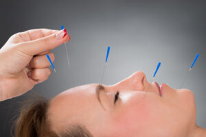 Acupuncture May Help With Seasonal Allergies – Informed Opinion