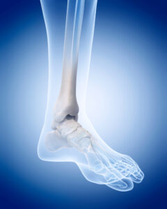 SIBO Conference Presentation Slides