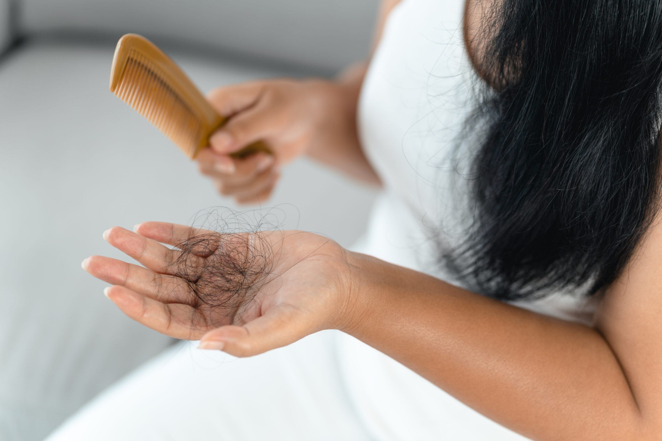 Hair Growth and Reduction in Hair Fall Associated with Saw Palmetto (<em>Serenoa repen</em>) Extracts