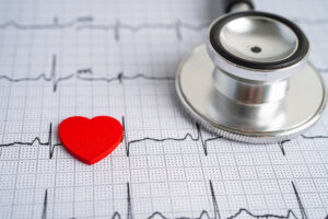 Alpha‑Lipoic Acid Supplement: Effect on Vascular Function and Inflammation Markers in Patients with Stroke