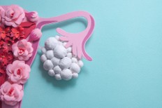 Insulin-Sensitizing Strategies and Supplements Useful for PCOS